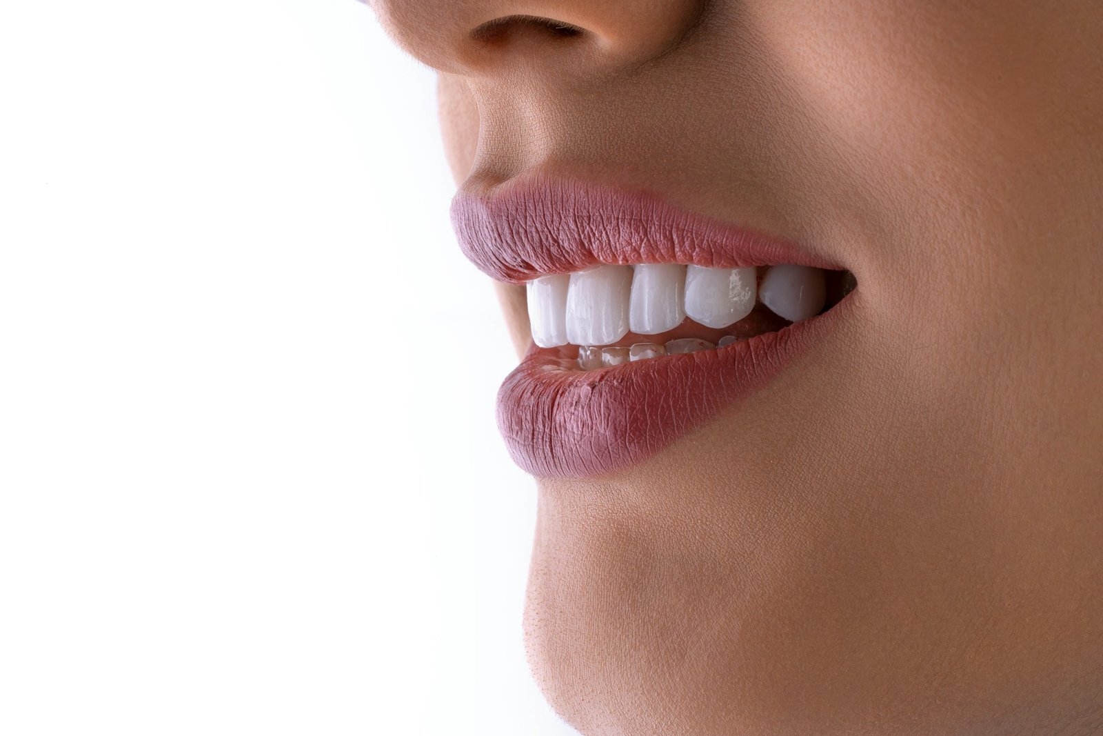 Professional teeth whitening at Clearview Dental